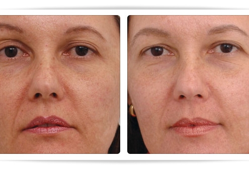 clínica dermatológica prontodermi