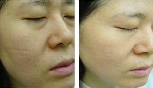 crosspelling01 clínica dermatológica prontodermi