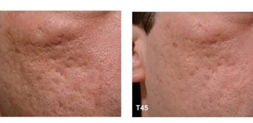 crosspelling02 clínica dermatológica prontodermi