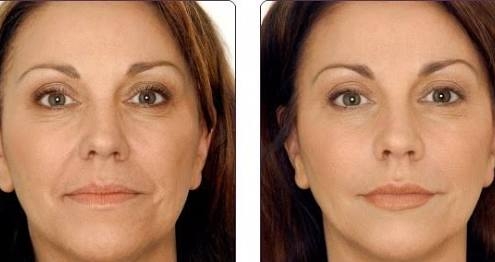 clínica dermatológica prontodermi