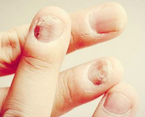 clínica dermatológica prontodermi