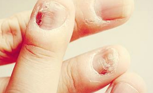 clínica dermatológica prontodermi