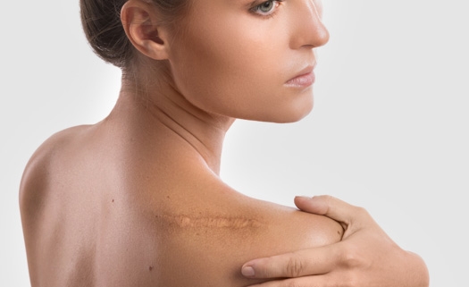 clínica dermatológica prontodermi